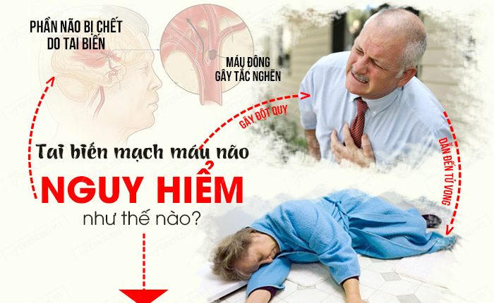 benh-tai-bien-mach-mau-nao-dan-den-tu-vong
