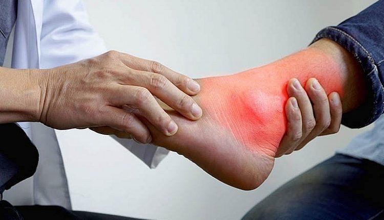 benh-gout-cap-tinh-nguyen-nhan-cach-cai-thien-tin-viet-today-vn